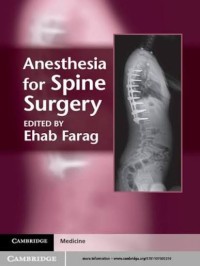 Image of Ebook Anesthesia for Spine Surgery